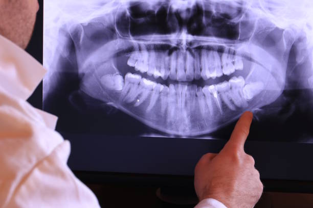 Best Pediatric Emergency Dentist in Lincoln Rk, PA